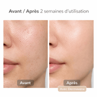 Dermavena Huile Nettoyante Centella — Double Nettoyage Doux
