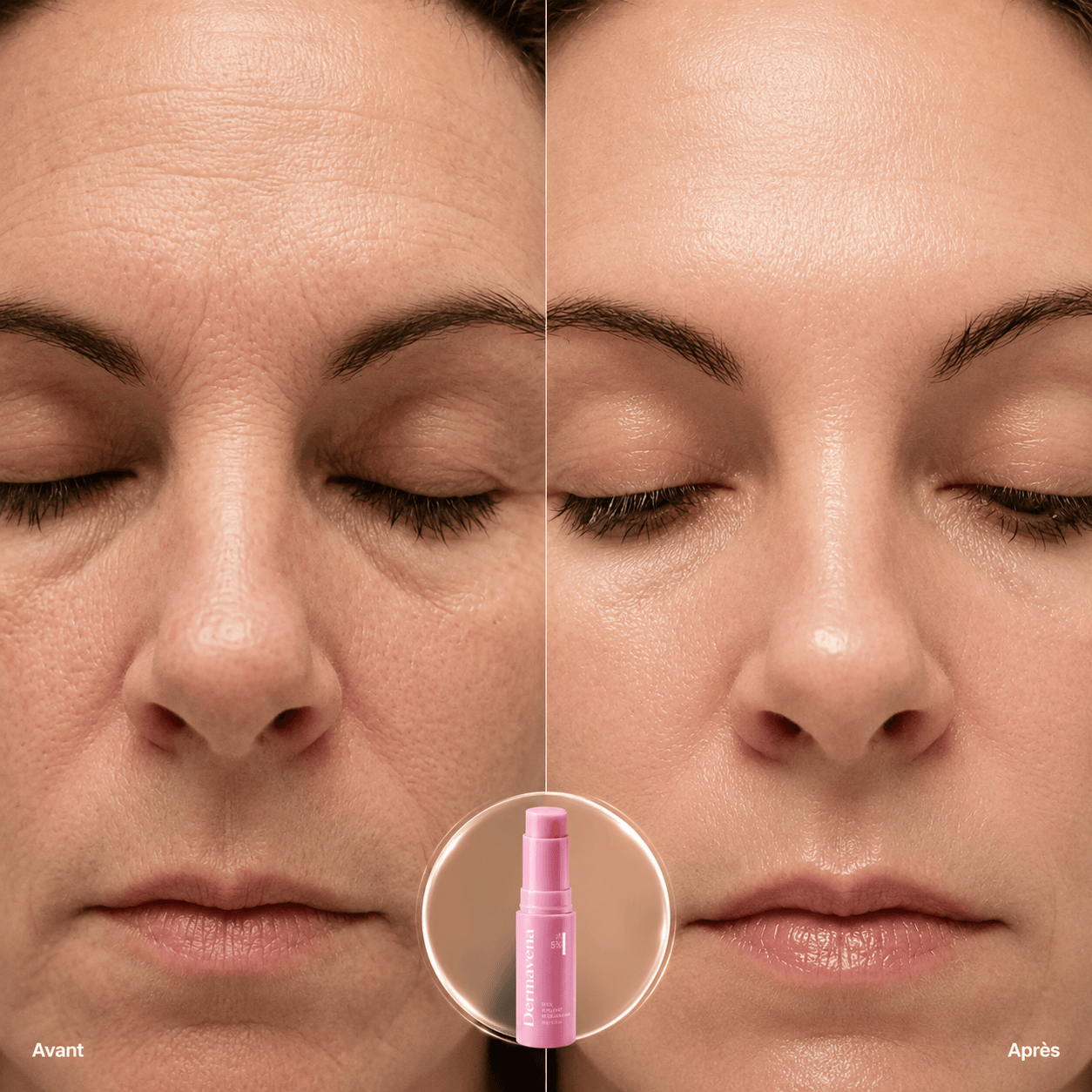 Dermavena Stick repulpant visage Dermavena LiftStick PDRN — Stick visage glow zones fatiguées